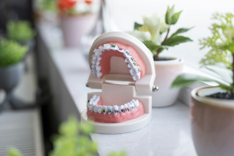 Korony porcelanowe czy cyrkonowe na implantach – które wybrać?