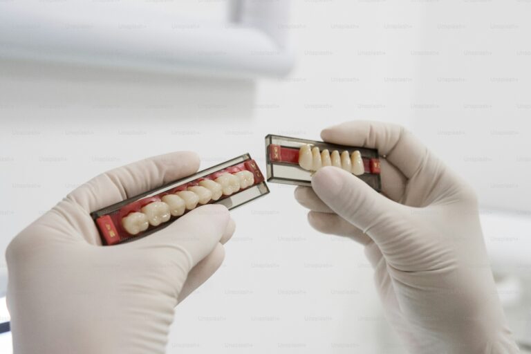 Jakie są zalety koron na implantach w porównaniu z mostem protetycznym?