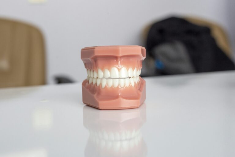 Jak dbać o mosty na implantach, by zachowały estetykę i funkcjonalność?