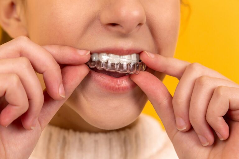 Jakie są zalety i wady mostów na implantach? Pełna analiza rozwiązania